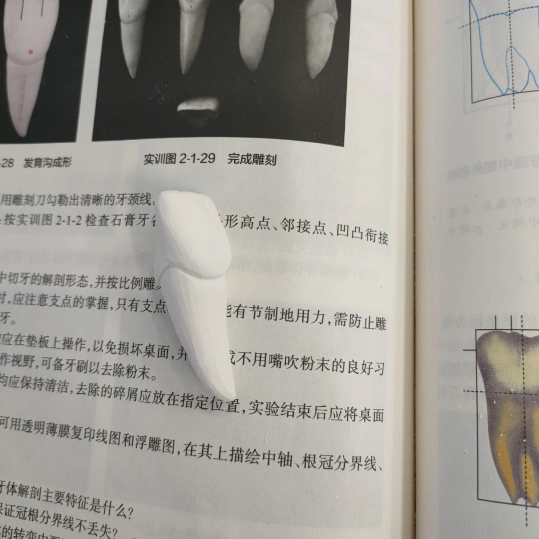 上颌中切牙的雕刻步骤图片