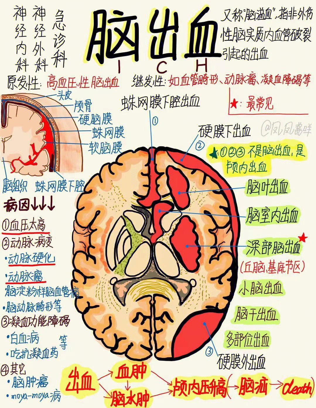 医学生笔记脑出血建议点赞收藏