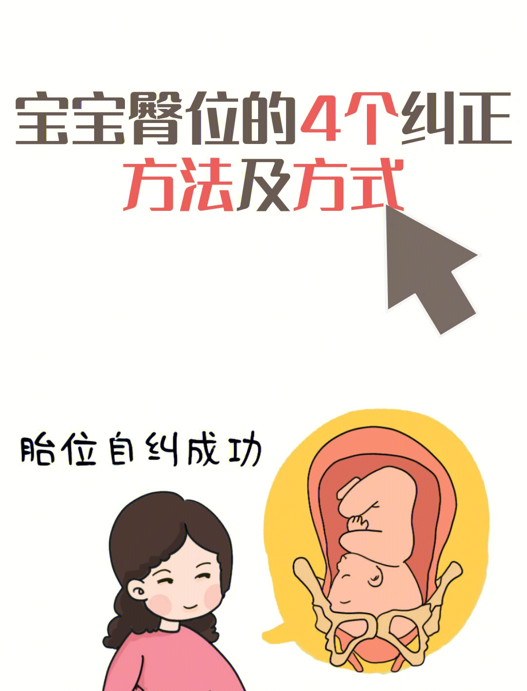 转胎位的姿势图正确图片