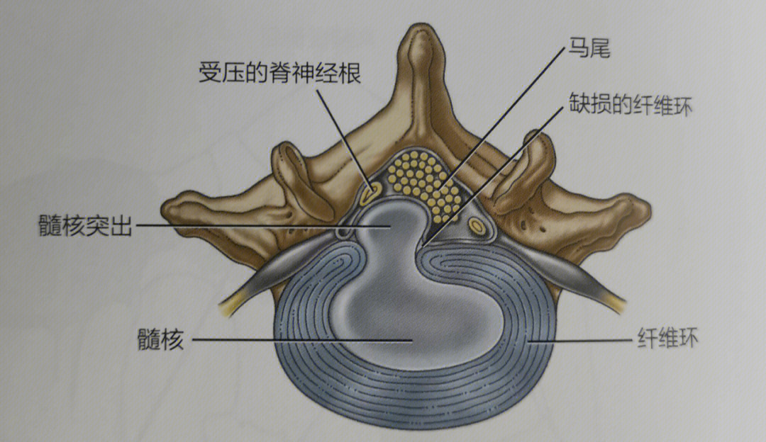 脊髓马尾位置示意图图片