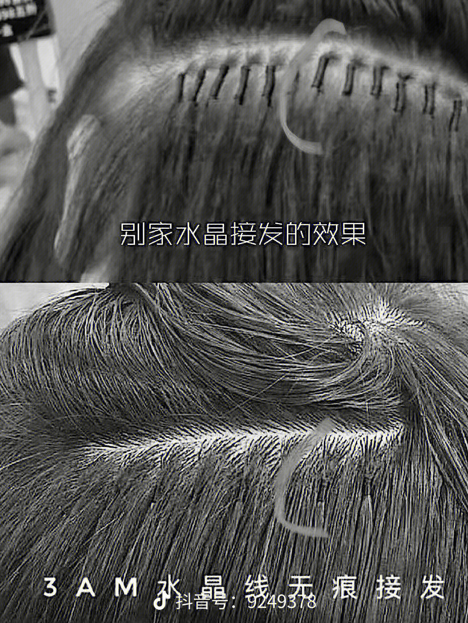 大连羽毛接发2接完头发真的太好看啦m2大连接头发哪里好米大连接发