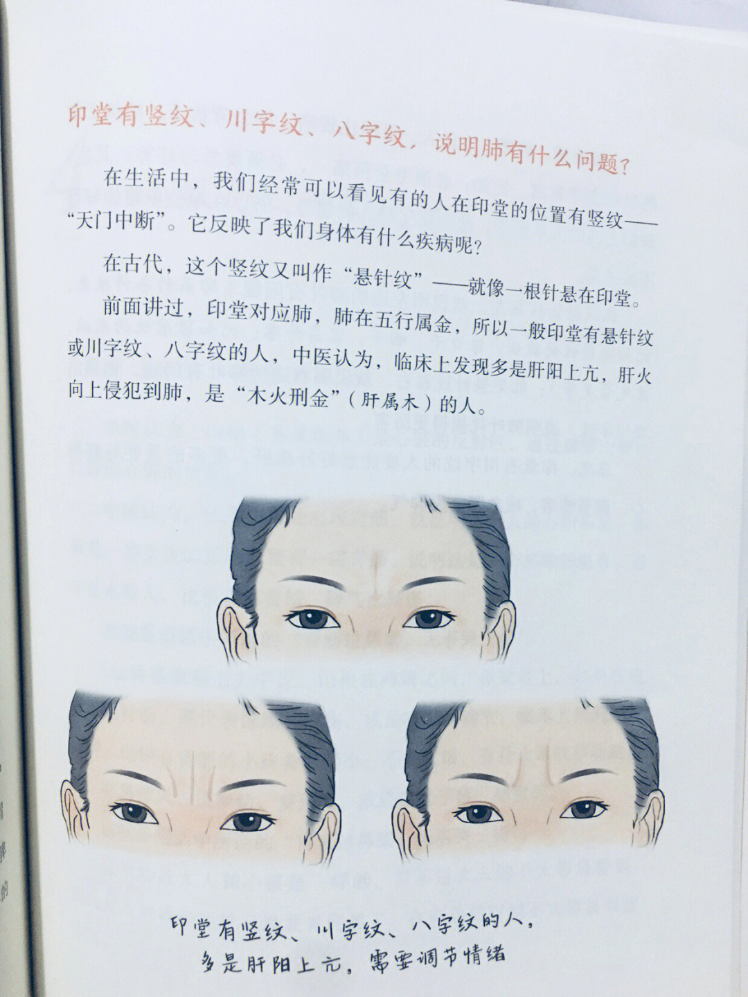 印堂口字纹图解图片