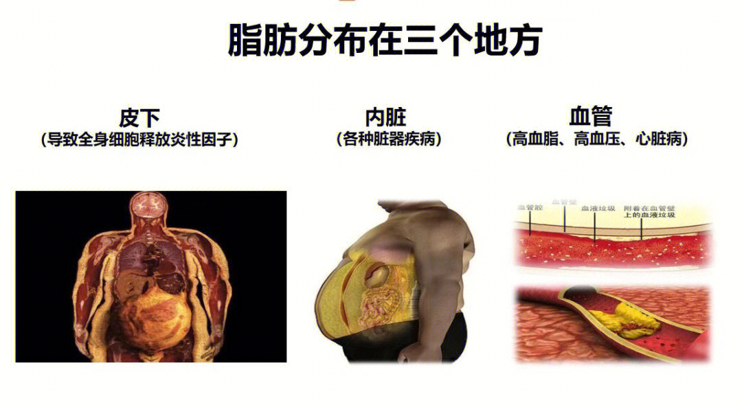 内脏脂肪解剖图片