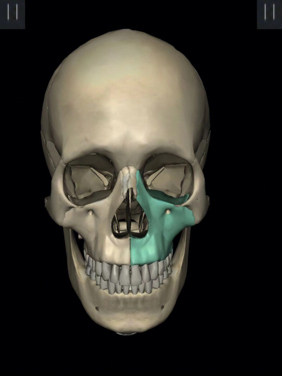 从图可看出,上颌骨连接鼻骨,上颌骨连接着颧骨—颞骨—枕骨,一般先