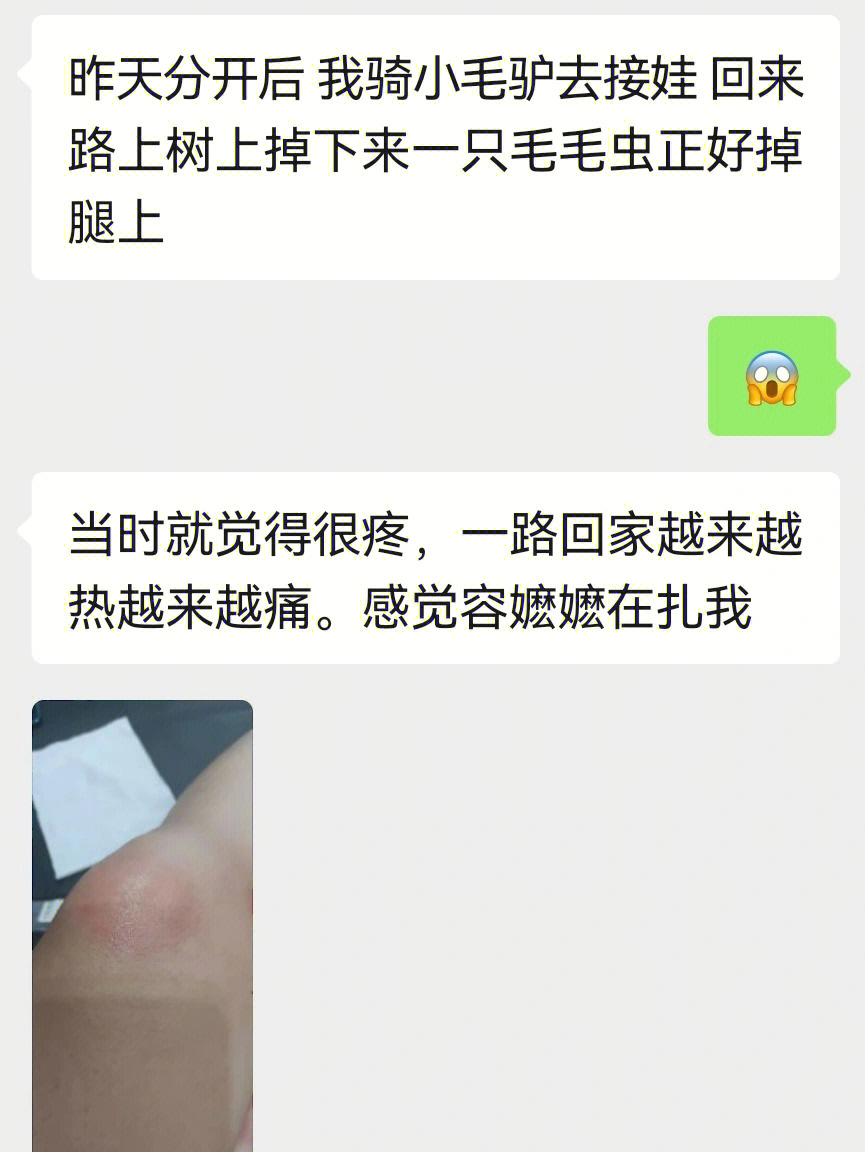 被毛毛虫蛰了怎么办图片