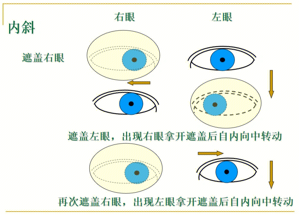 斜视图的作用图片