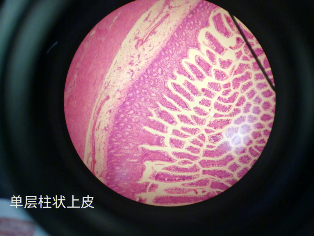 单层柱状上皮 学生图片