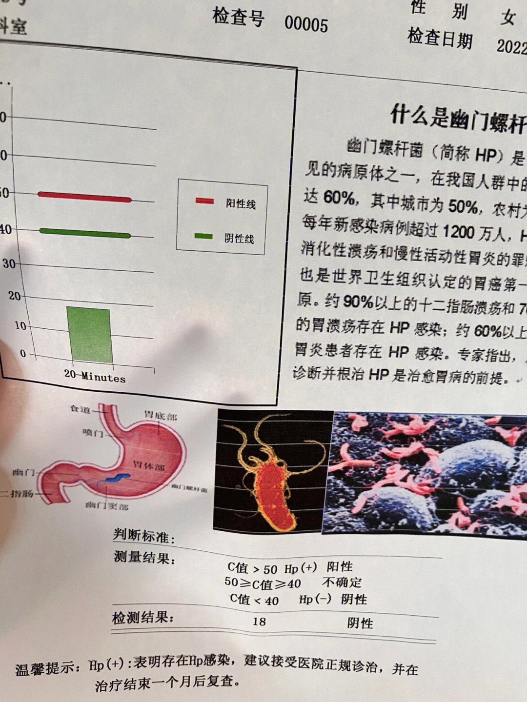 hp幽门螺杆菌对照表图片