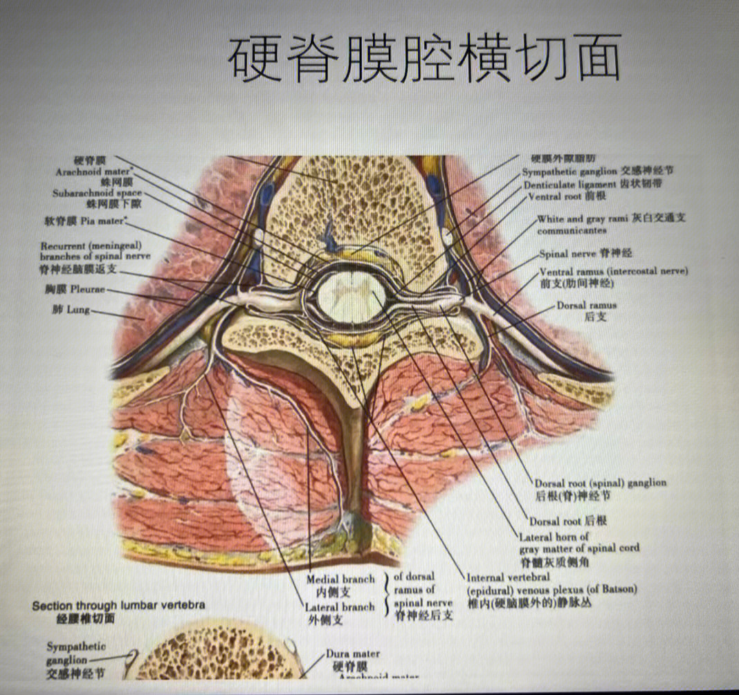 腰椎硬膜囊受压图片