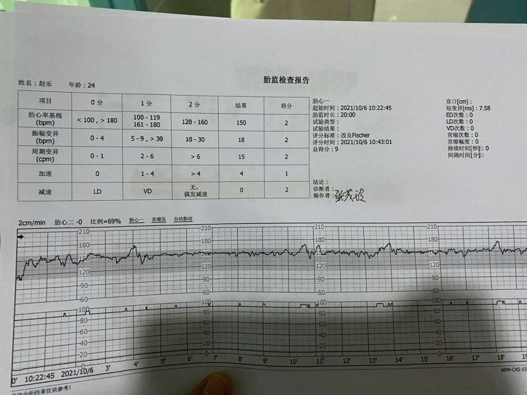胎心监测怎么才算合格图片