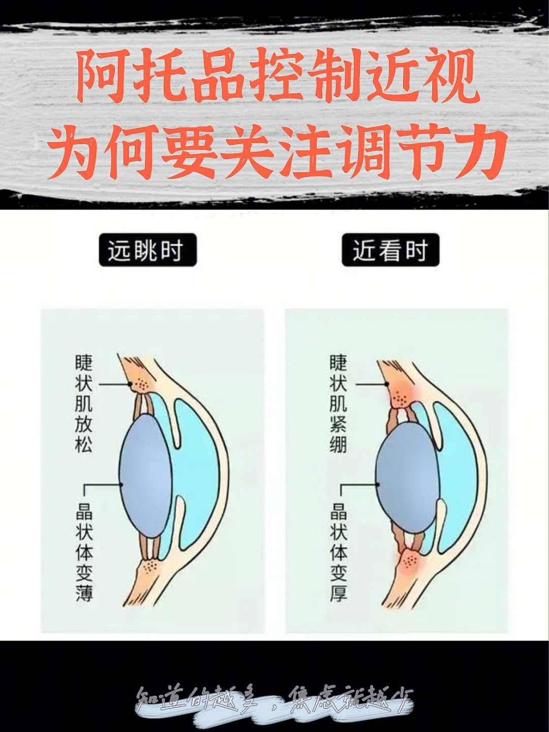 睫状肌收缩原理图片