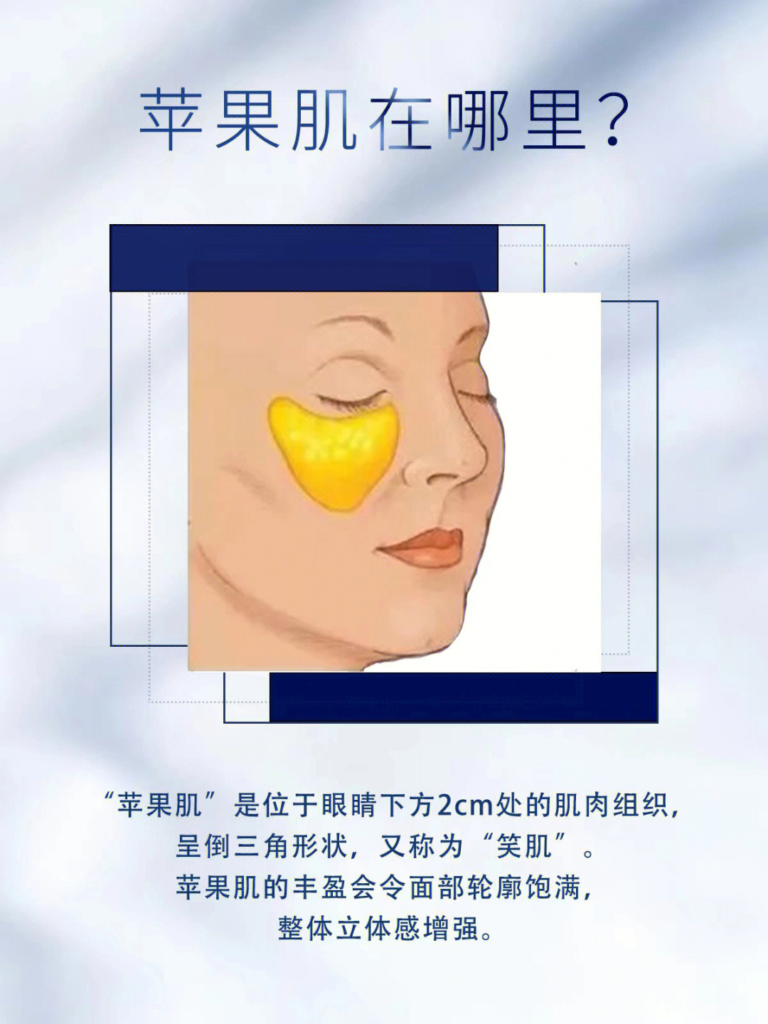 苹果肌太大怎么办图片