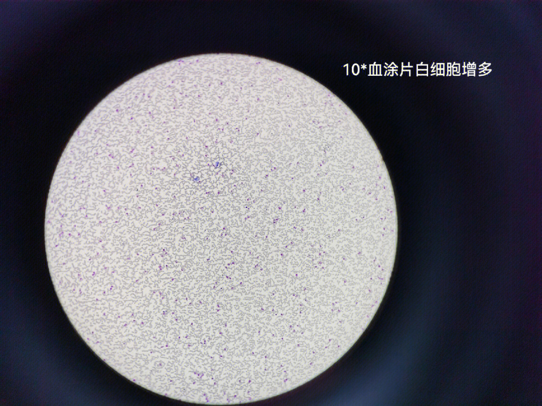 白细胞未染色图片