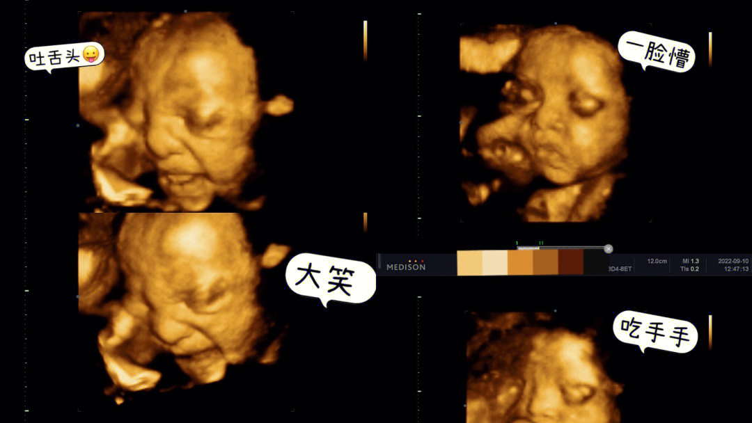 胎动表情包图片