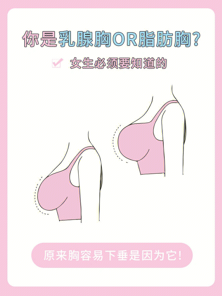 冷知识你是乳腺胸or脂肪胸