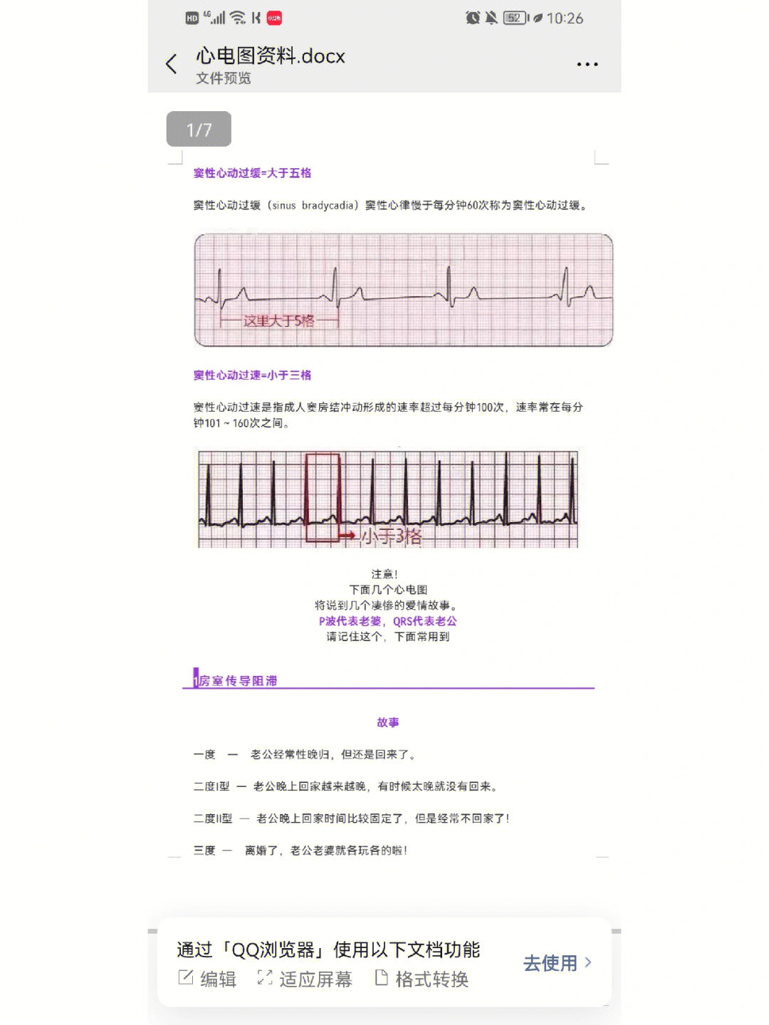 心电图考试口述流程图片