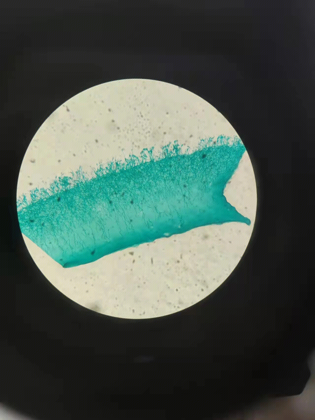 青霉的显微镜形态绘图图片