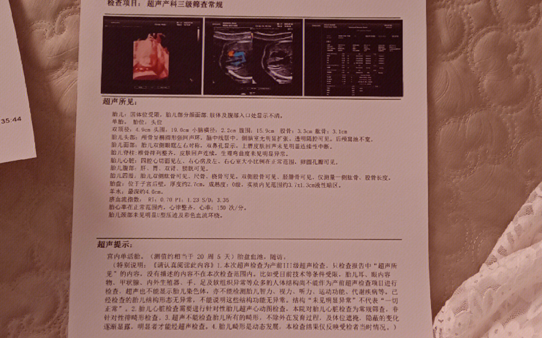 胎盘血池图片