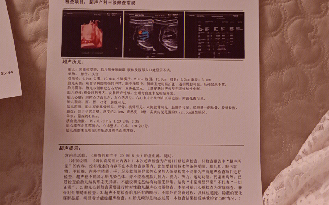 胎盘畸形图片