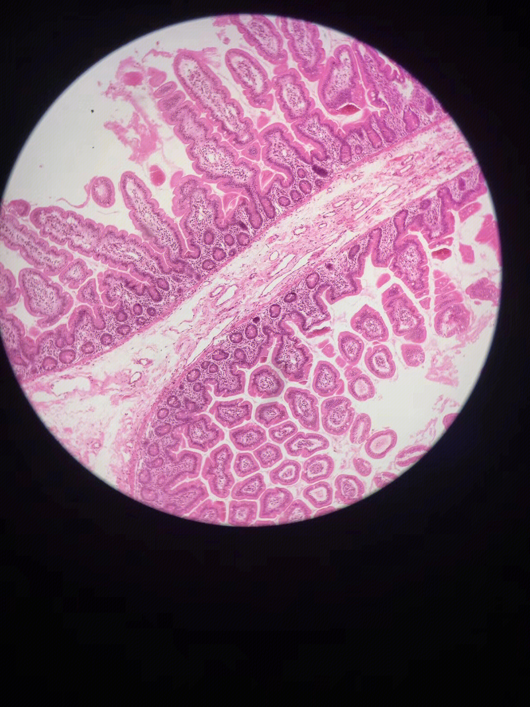 空肠显微镜下的结构图片