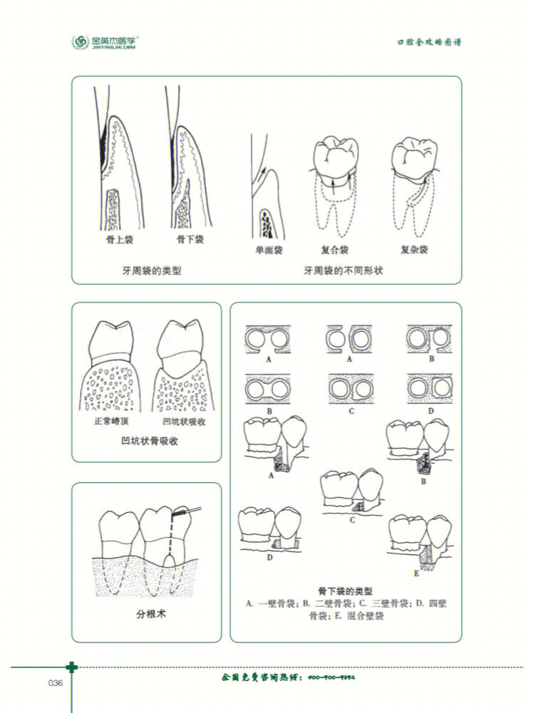 口腔观测线分类图解图片