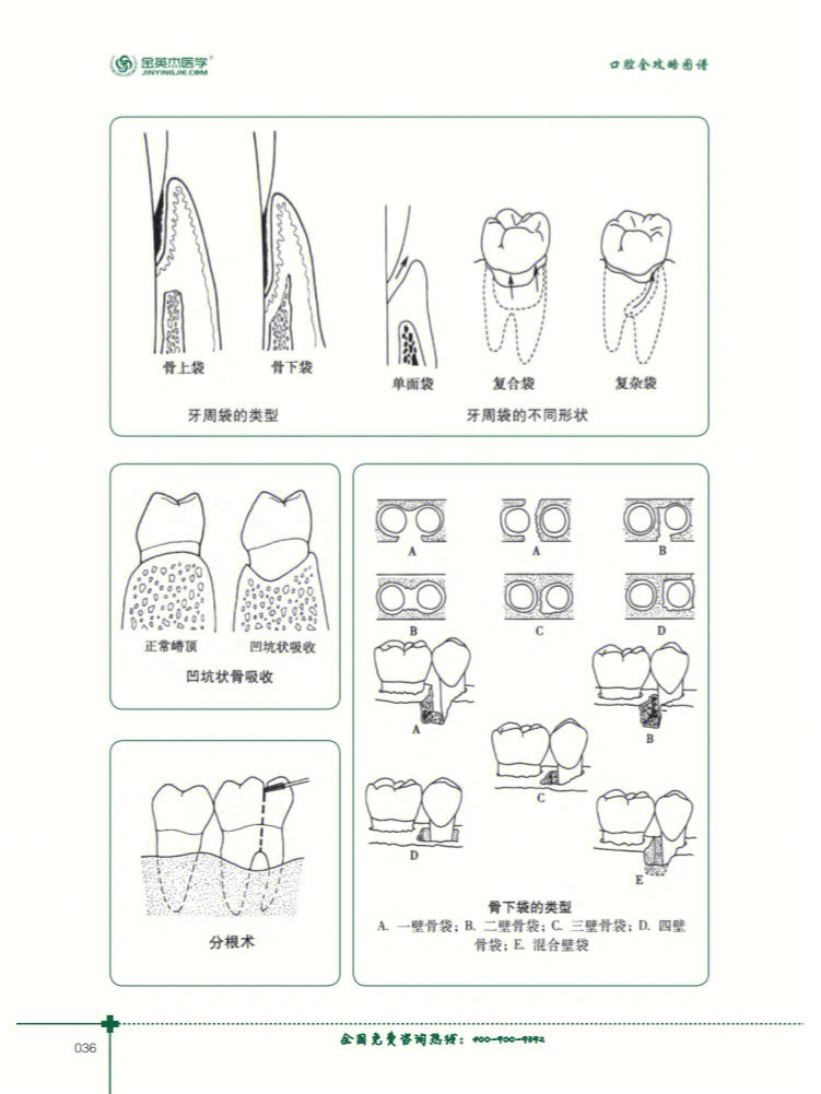 口腔线角和点角图片图片