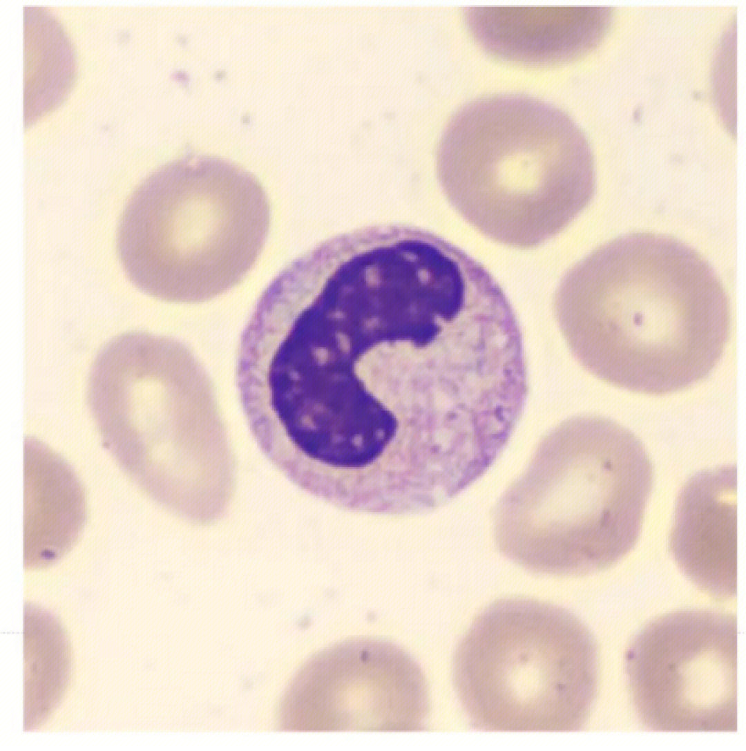 〈特点:形状不规则〉淋巴细胞〈特点:核大〉嗜酸性分叶核粒细胞中性