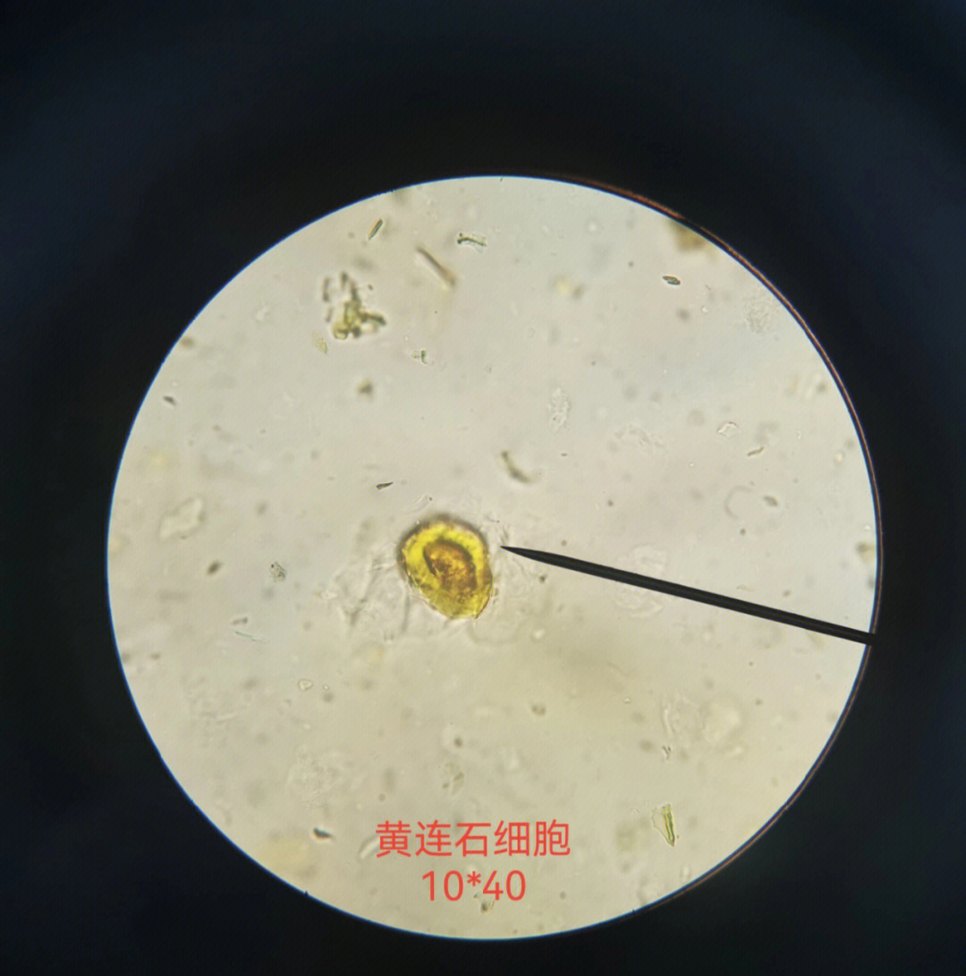 梨果实的石细胞显微镜图片