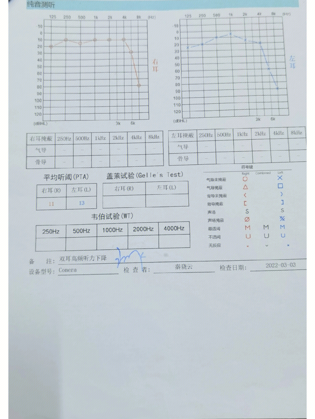 因为检查出来eb阳然后去中一看了,听到耳鸣,耳痛医生让做听力检测