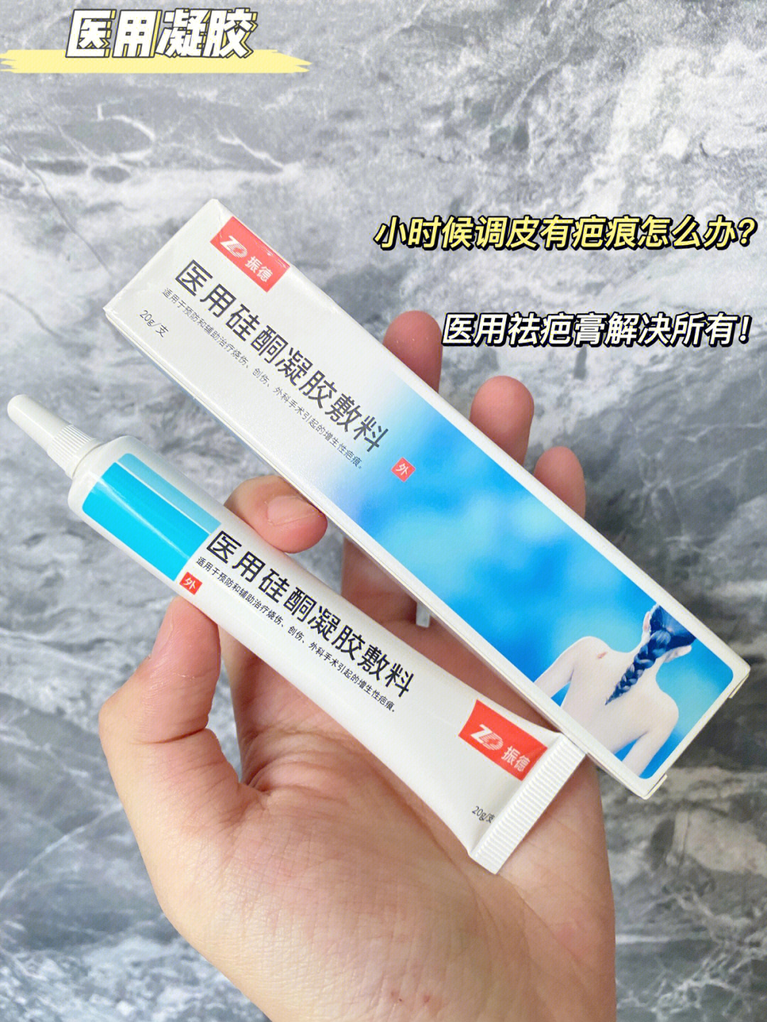 摸了烫伤膏之后还是留疤了后来经过朋友的推荐,就买了振德疤痕膏,本来