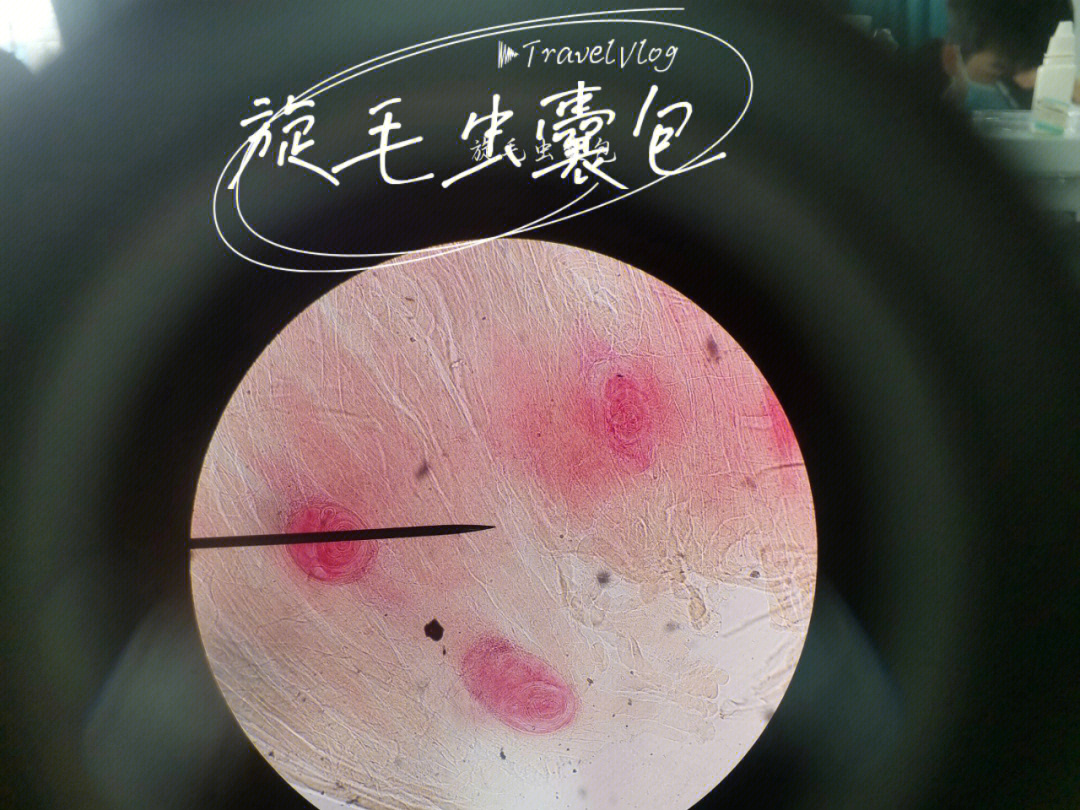 马来微丝蚴显微镜图片