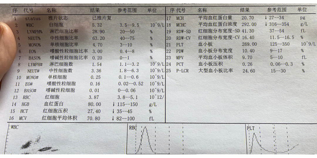 贫血血常规化验单图片图片