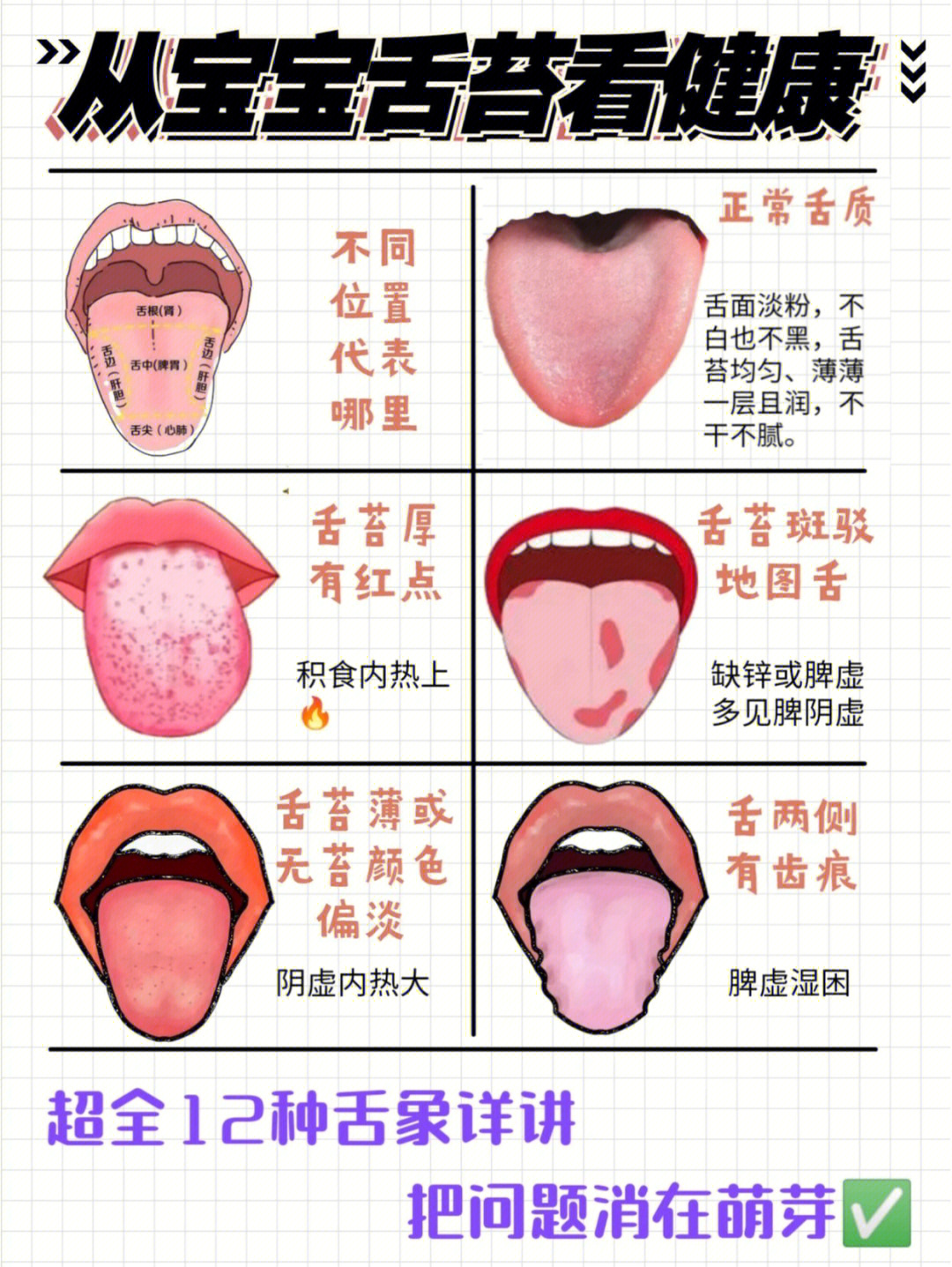 小儿舌苔辩证带图图片