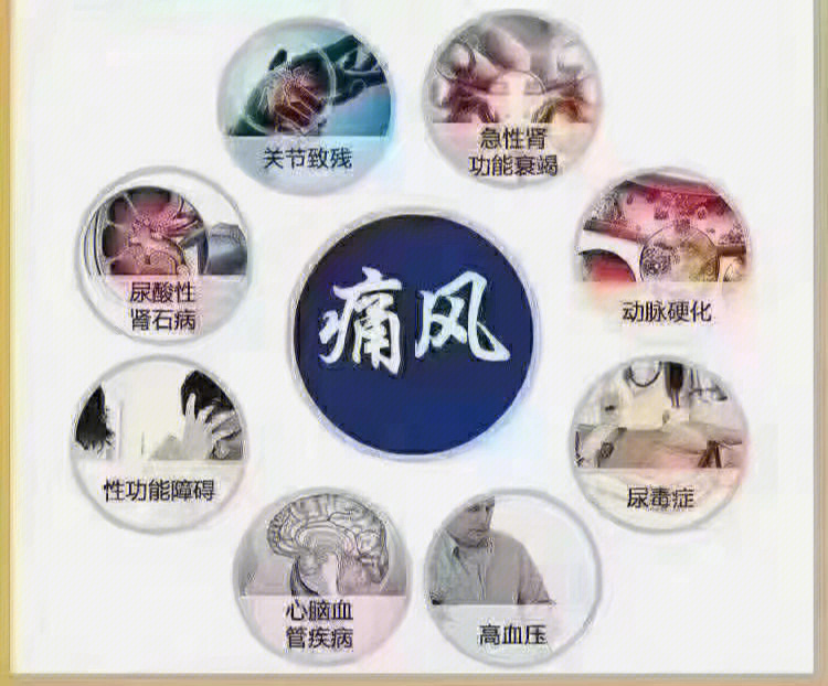 痛风可以根治吗图片