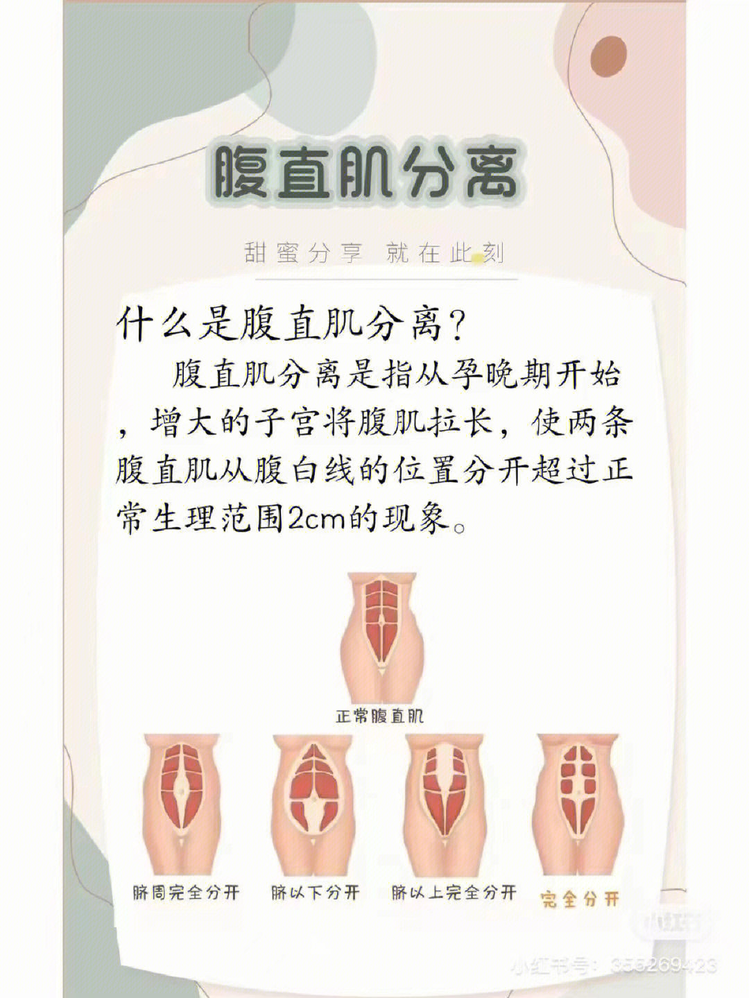 78腹直肌分离程度及危害
