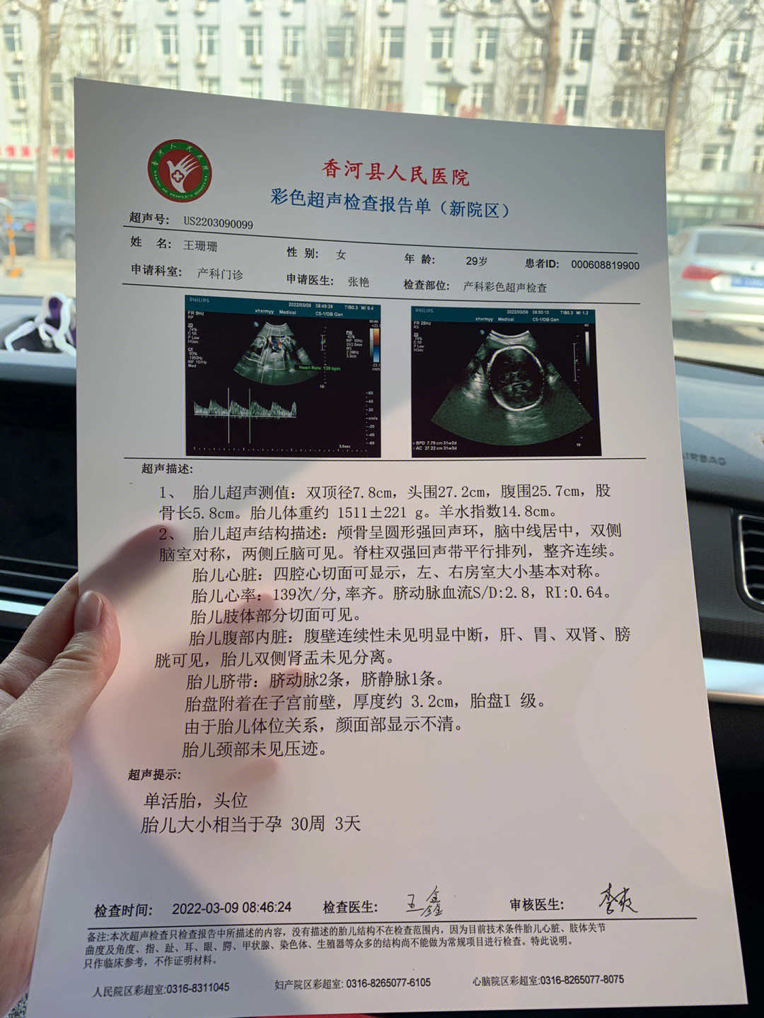 怀孕30天彩超报告图片图片