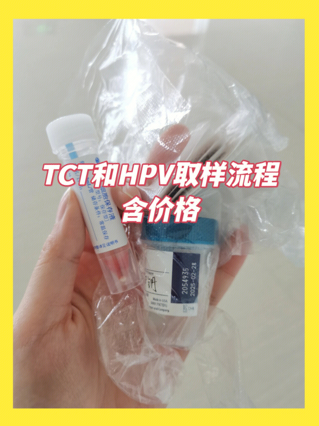 攻略hpv和tct检查流程