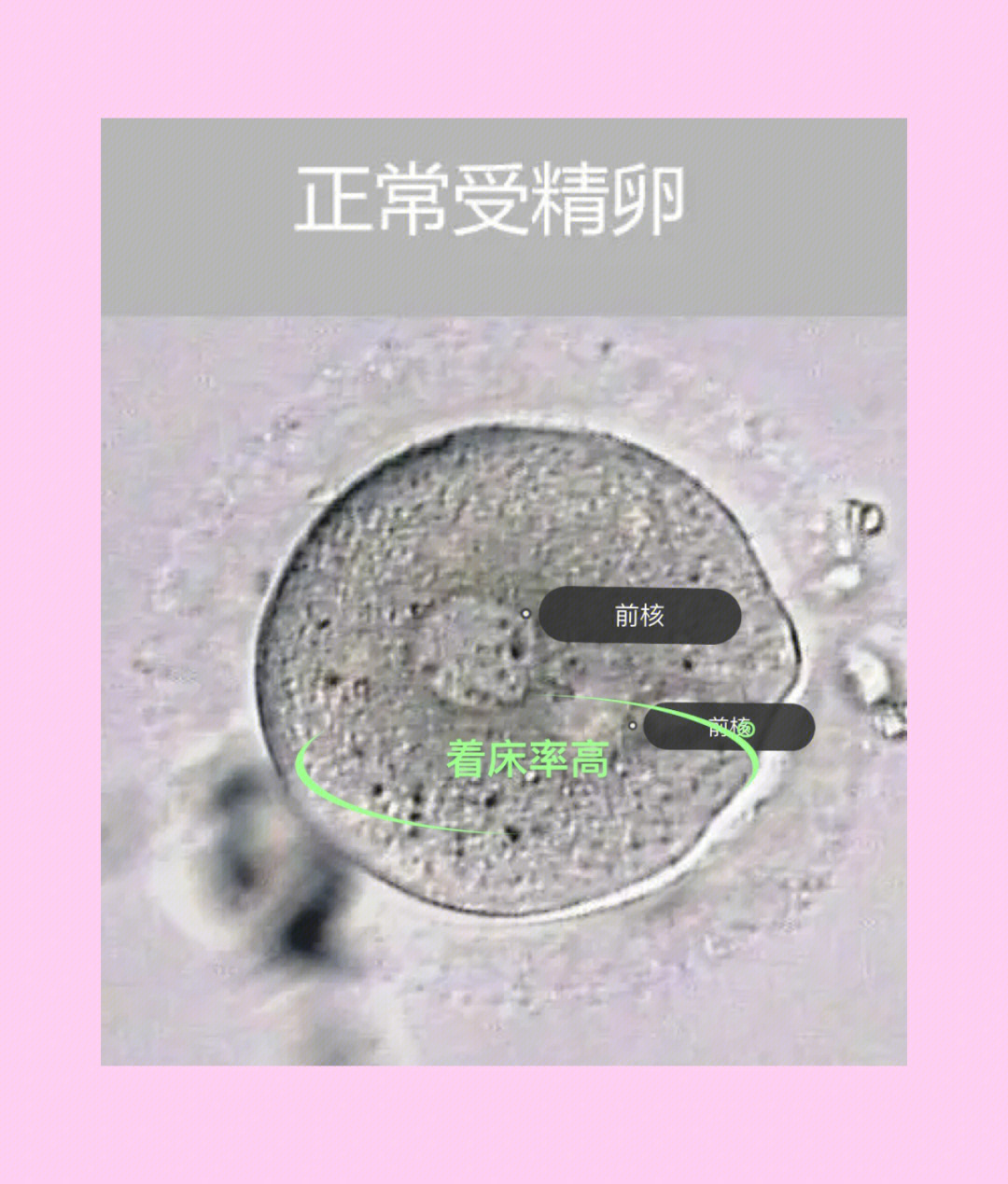 7878什么样的受精卵100着床7878