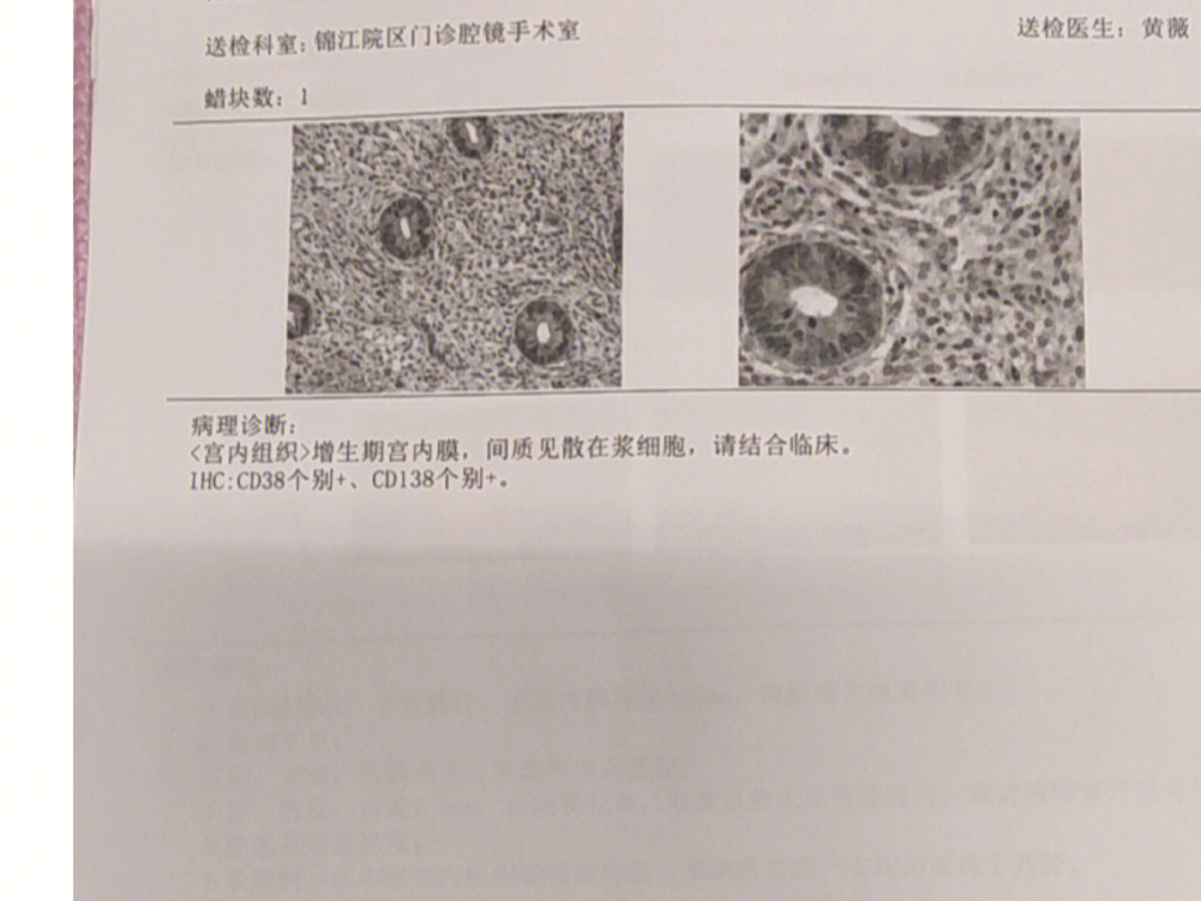 宫腔镜病理报告图片图片