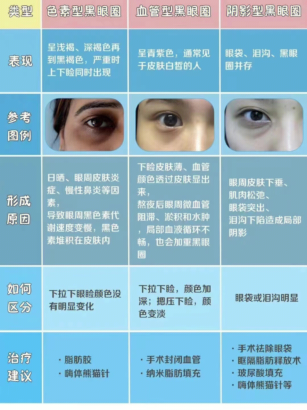 一张图看懂你的黑眼圈属于哪一