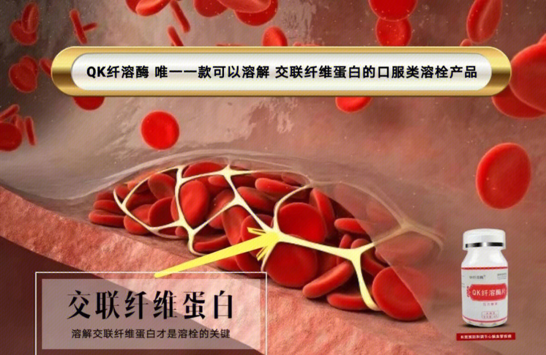 纤溶酶Qk肠溶胶囊图片
