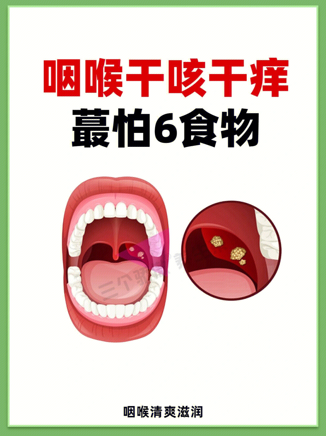 咽喉干咳干痒咳嗽不停润肺护嗓