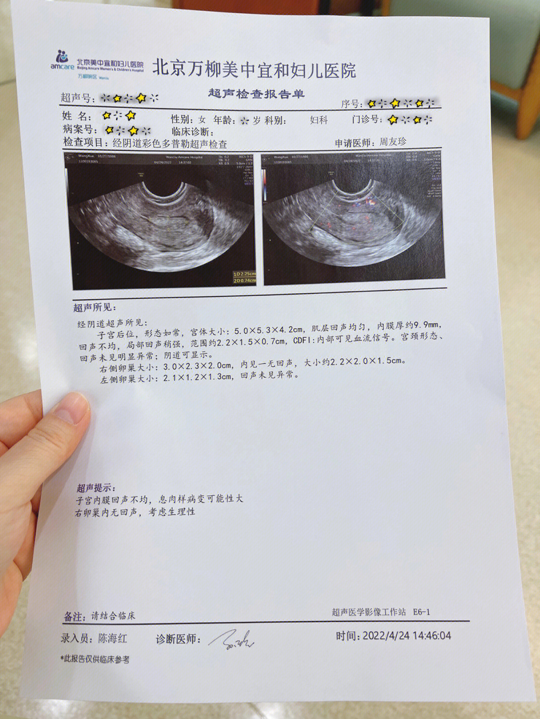 宫颈息肉病理报告图片