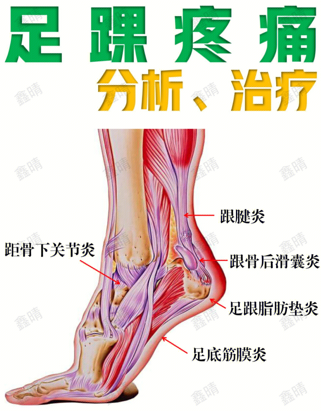 脚距骨疼图片