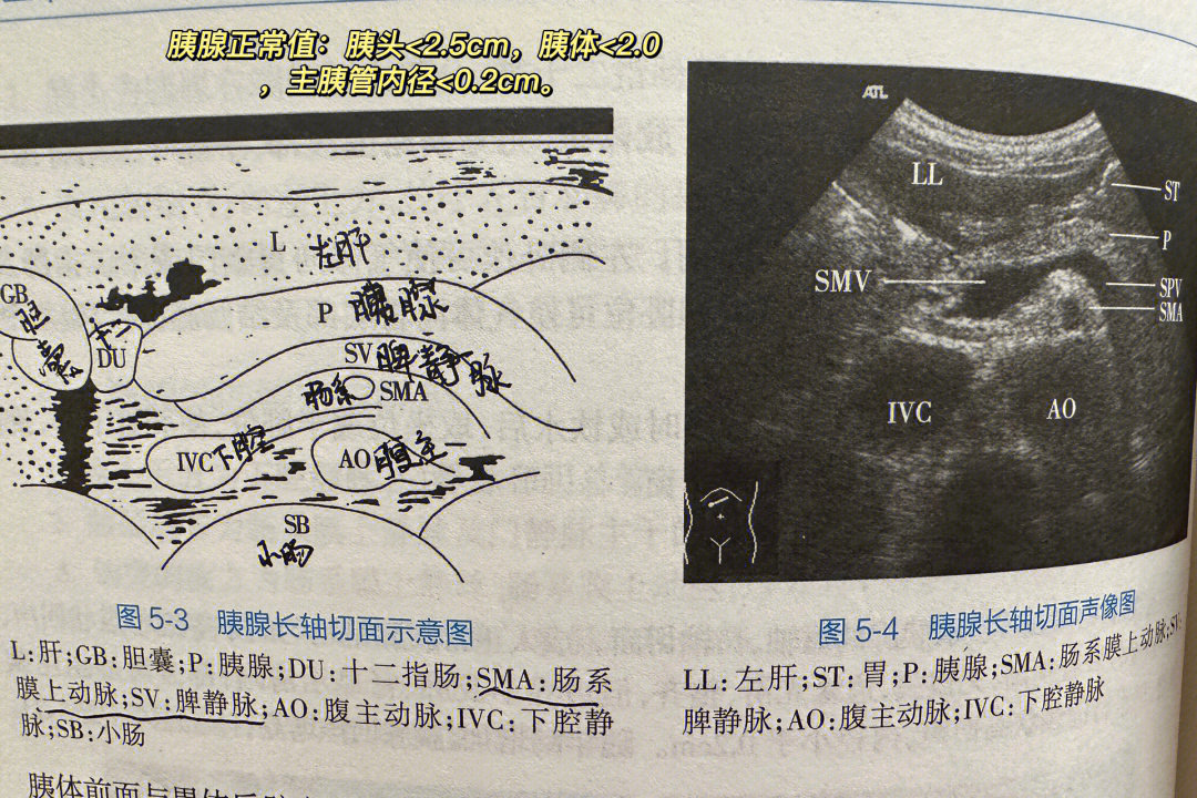 1028超声学习打卡第4day补充胰管