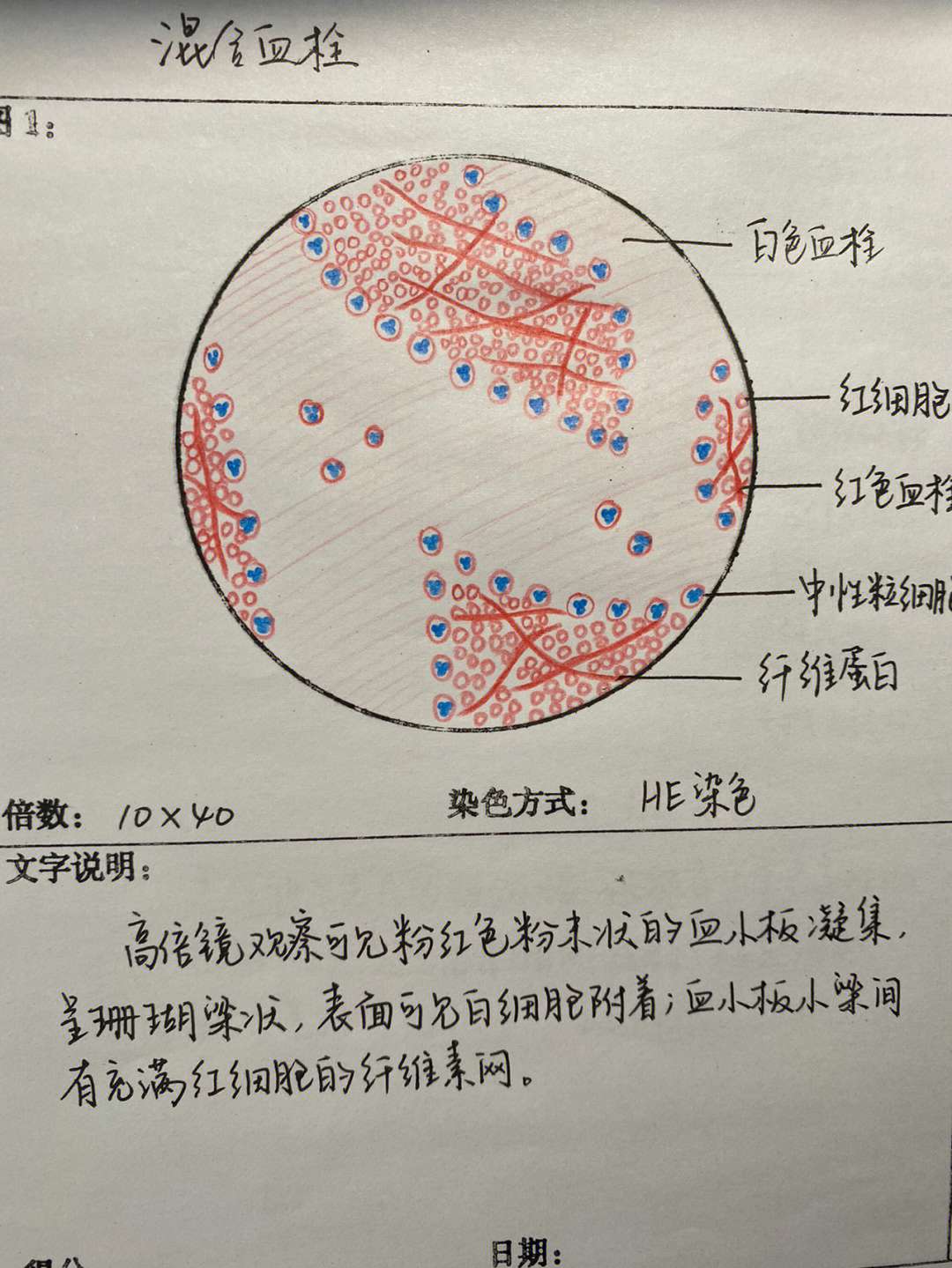 病理红蓝铅手绘图