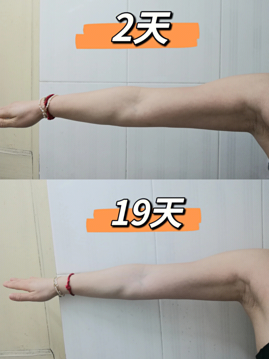韩小四瘦手臂运动图片