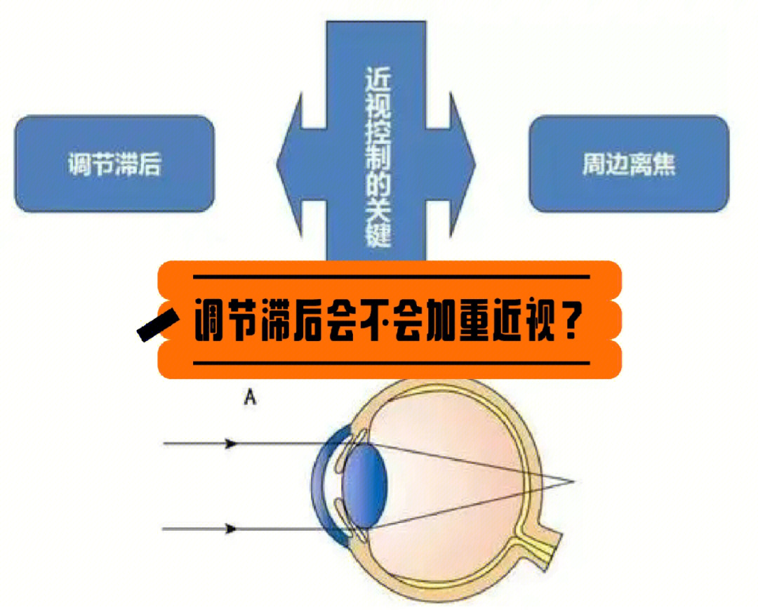 睫状肌收缩原理图片