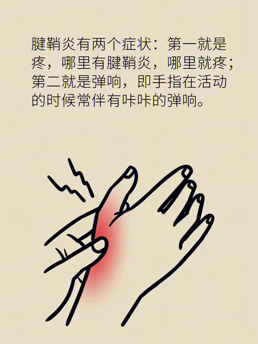 食指腱鞘炎的症状图图片
