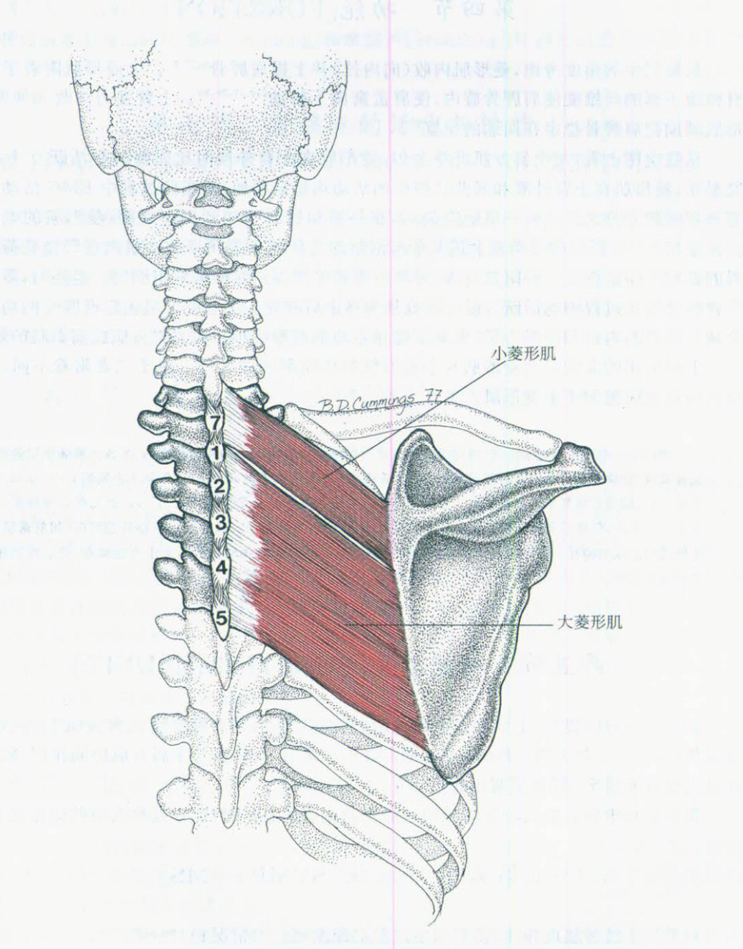 菱形肌竖脊肌图片